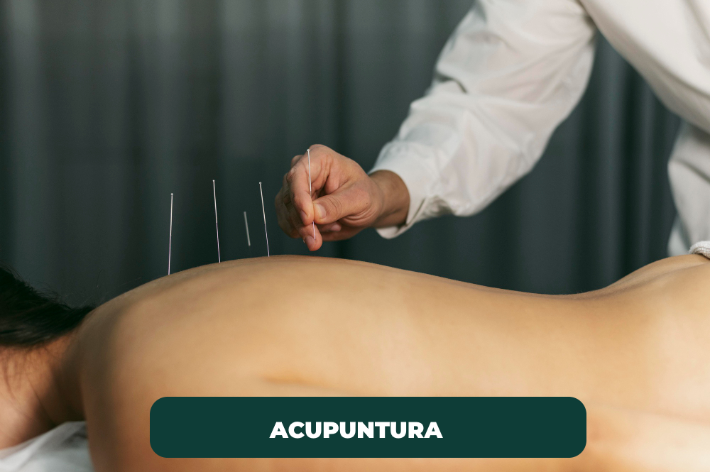 acupuncture-process (1)